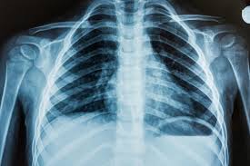 Need an Xray Near Me? Visit Innovative Urgent Care Today